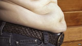 Считается, что четверть взрослого населения Великобритании страдает ожирением