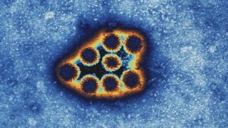 retrovirus