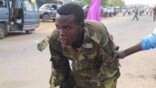 A man in uniform injured in the suicide attack in Dusa Mareb on 1 May 2012