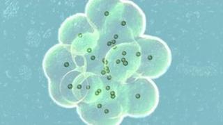 In vitro fertilisation 01/03/2009 Science Photo Library