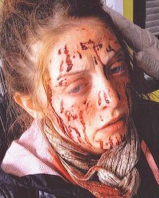 Southend mugging victim Leanne