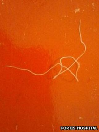 The 13cm-long worm.