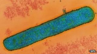 Anthrax bacterium