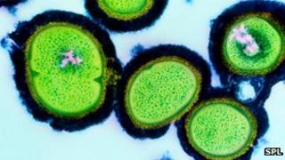 Drug-resistant MRSA