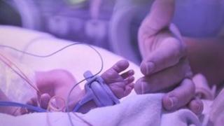 Baby in an incubator