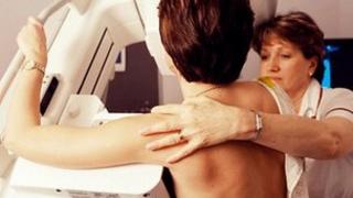 Mammogram