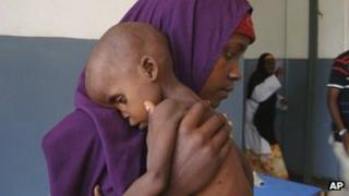 Woman holding undernourished child in Somalia