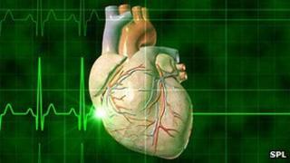 Flat line heart monitor
