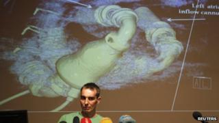Jakub Halik at a press conference after his operation in April 2012