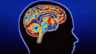 Brain scan