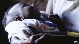 Baby with HIV