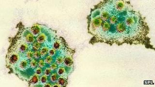 Norovirus