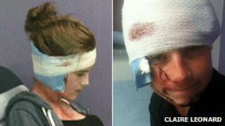 Jessica and Callum after the attack
