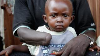 An amputee and his child in Sierra Leone (26 November 2006)