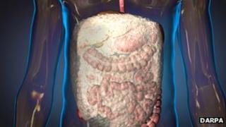 Foam to limit blood loss