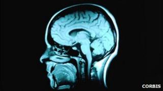 Sgan MRI