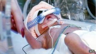 Baby in neonatal intensive care