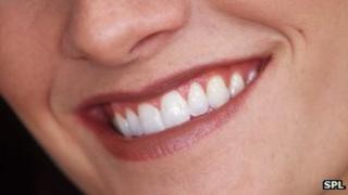 Smile