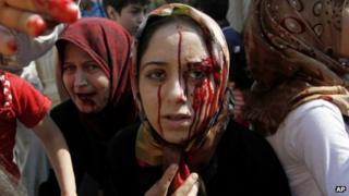 Injured Syrian women arrive at a field hospital after an air strike hit their homes in the town of Azaz, on the outskirts of Aleppo, Syria, on 15 August 2012