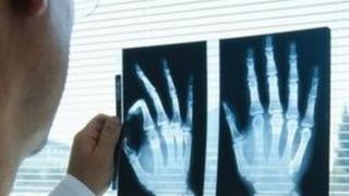 X-ray