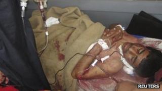Wounded man in hospital after Kirkuk clashes (23 April 2013)