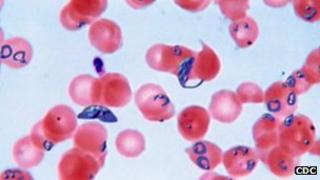 Plasmodium falciparum