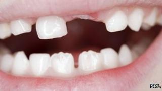 Teeth
