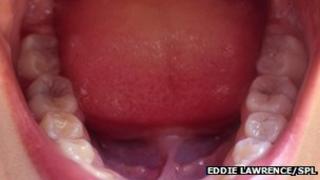 Inside the mouth