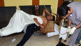 People, affected by what activists say is nerve gas, are treated at a hospital in Duma