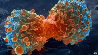 Клетки рака легких