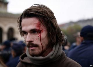 Раненая протестующая в Софии, 12 ноября (фото Анны Стамболиевой)