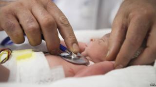 Premature baby