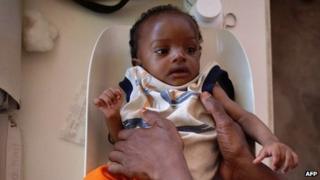 A Somali baby is weighed before receiving a vaccination at a clinic in Mogadishu.