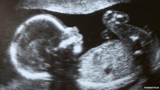 Ультразвуковое сканирование ребенка в утробе матери
