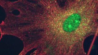 Research into brain tumours