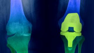 Biomet