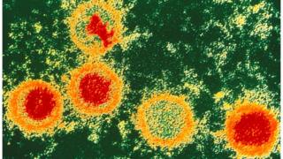 Epstein Barr virus