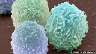White blood cells, coloured scanning electron micrograph including one neutrophil (right)