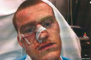 Man with slashed face