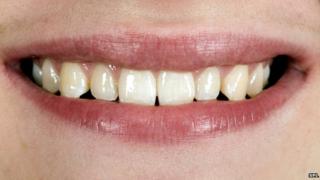 Teeth