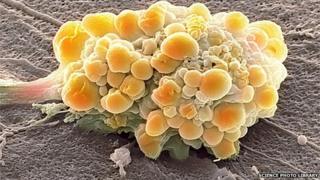 The most common site for gliomas is the brain