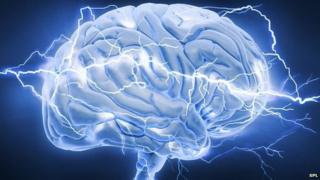 electric brain
