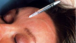 Picture of an injection given to the forehead