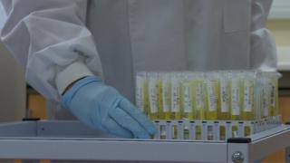 Urine samples