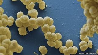 meningitis