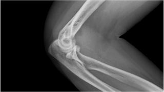 X-ray