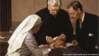 Early eye operations were performed with no anaesthetic