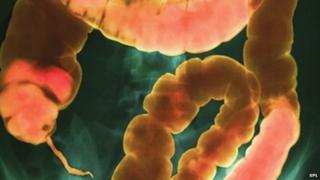 Picture of human gut