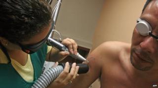 New Zealand: Prisoners offered cut-price tattoo removal ...