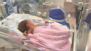 Baby at Barnsley Hospital Special Care Baby Unit